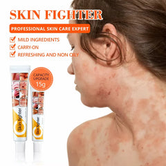 Skin Fighter Herbal Repair Ointment - Each