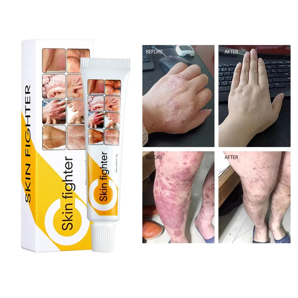 Skin Fighter Herbal Repair Ointment - Each