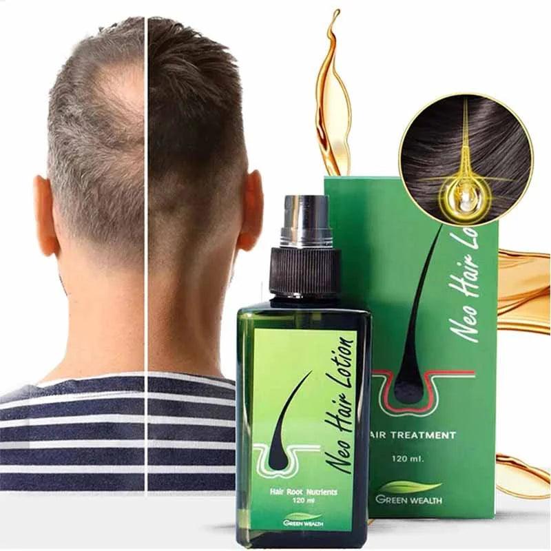 New Hair Lotion Hair Growth (Made in P.R.C)