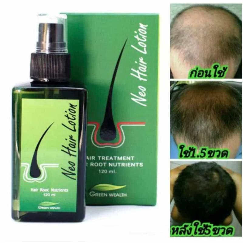 New Hair Lotion Hair Growth (Made in P.R.C)