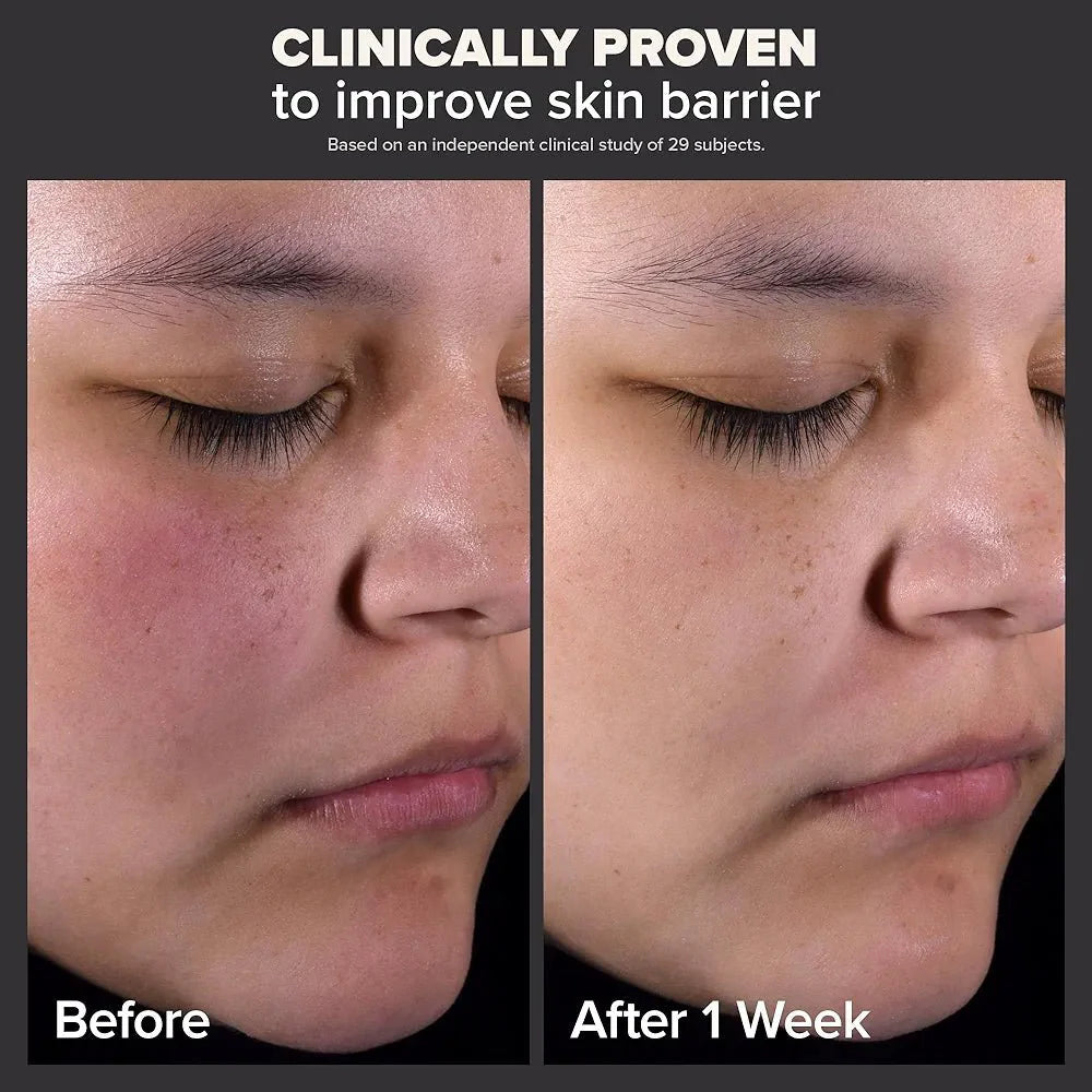 Paula’s Choice Skin Perfecting 2% BHA Liquid Exfoliant - 118ml