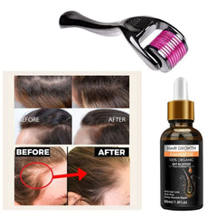 Hair Growth Oil Derma Roller 0.55mm For Faster Hair Growth - Pack Of 02